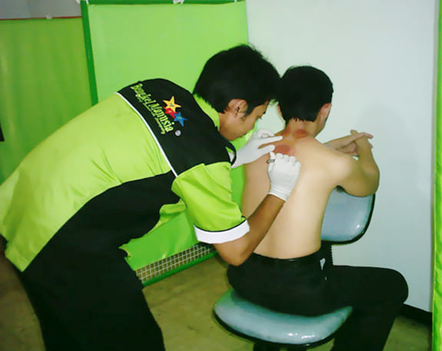 Manfaat Terapi Bekam untuk Nyeri Neuropatik Kronik